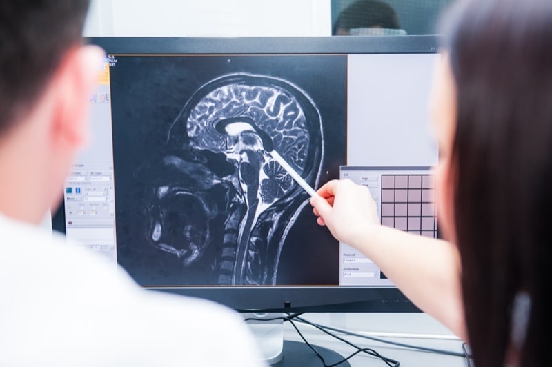 Finding a Head Injury Lawyer in Texas