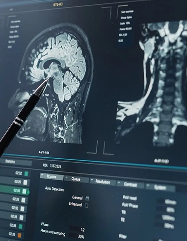 Traumatic brain injuries